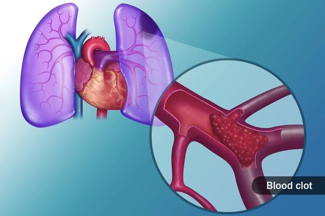Breathing and Exchange of Gas